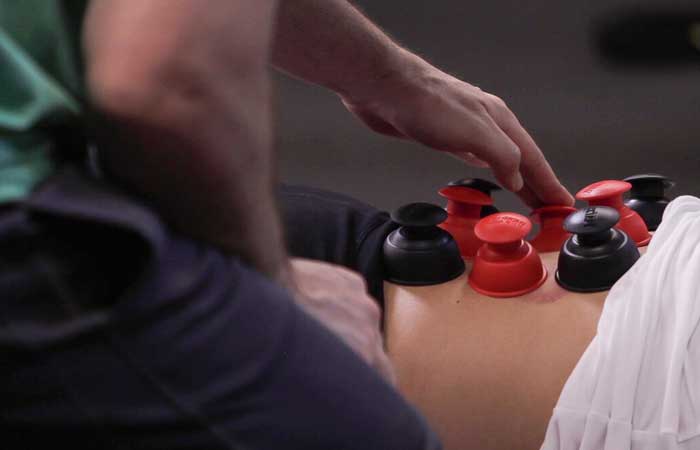 Functional Cupping Therapy